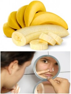 manfaat pisang untuk komedo